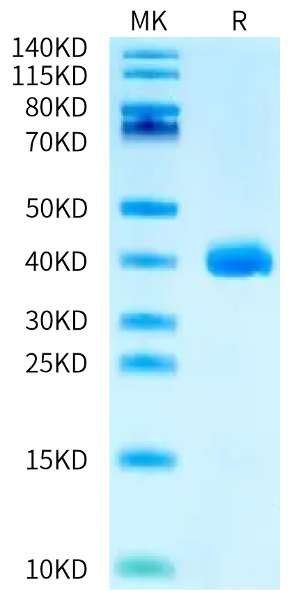 Biotinylated Human APOE3 on Bis-Tris PAGE under reduced condition. The purity is greater than 95%.Biotinylated Human APOE3/Apolipoprotein E Protein