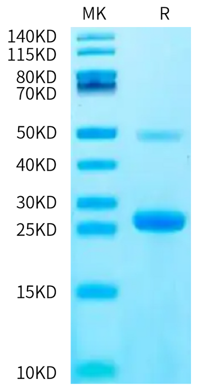 Biotinylated Human IL-17C on Bis-Tris PAGE under reduced condition. The purity is greater than 95%.Biotinylated Human IL-17C Protein, Active
