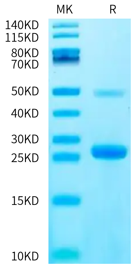 Biotinylated Human IL-17C on Bis-Tris PAGE under reduced condition. The purity is greater than 95%.Biotinylated Human IL-17C Protein, Active