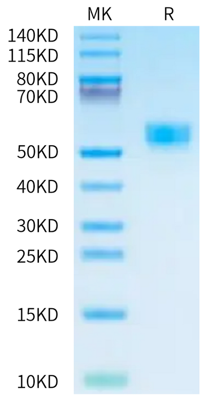 Cynomolgus Kremen-2 on Tris-Bis PAGE under reduced condition. The purity is greater than 95%.Recombinant Cynomolgus Kremen-2 Protein, Active