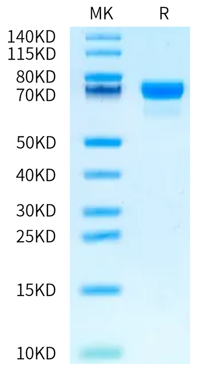 Human PD-L1 on Bis-Tris PAGE under reduced condition. The purity is greater than 95%.Recombinant Human PD-L1/B7-H1 Protein, Active