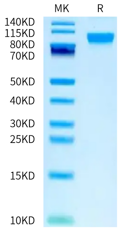Human LIV-1 on Bis-Tris PAGE under reduced condition. The purity is greater than 95%.Recombinant Human LIV-1/SLC39A6 Protein, Active