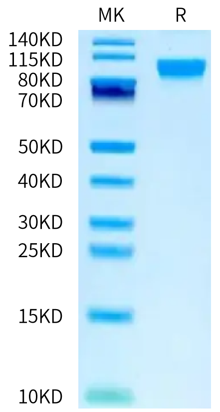 Human LIV-1 on Bis-Tris PAGE under reduced condition. The purity is greater than 95%.Recombinant Human LIV-1/SLC39A6 Protein, Active
