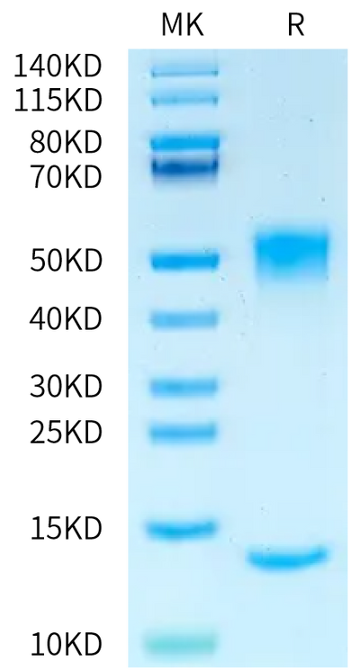 Rat FcRn on Bis-Tris PAGE under reduced condition. The purity is greater than 95%.Recombinant Rat FcRn Protein, Active