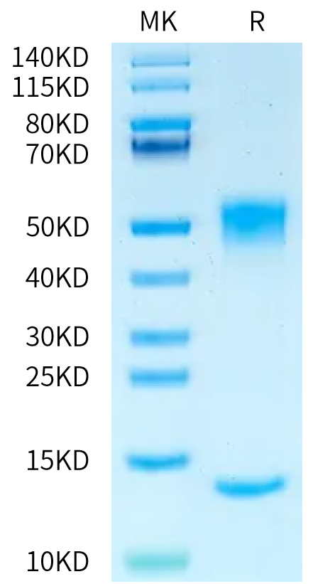 Rat FcRn on Bis-Tris PAGE under reduced condition. The purity is greater than 95%.Recombinant Rat FcRn Protein, Active
