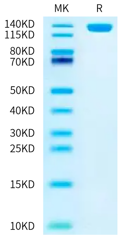 Human NCAM-1 on Bis-Tris PAGE under reduced condition. The purity is greater than 95%.Recombinant Human NCAM-1/CD56 Protein, Active