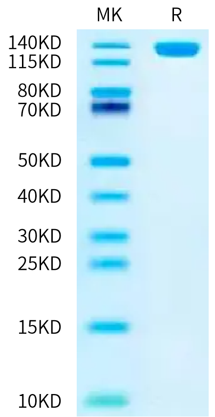 Human NCAM-1 on Bis-Tris PAGE under reduced condition. The purity is greater than 95%.Recombinant Human NCAM-1/CD56 Protein, Active