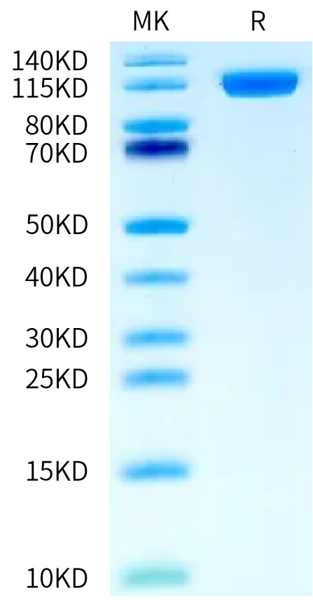 Biotinylated Human NCAM-1 on Bis-Tris PAGE under reduced condition. The purity is greater than 95%.Biotinylated Human NCAM-1/CD56 Protein, Active