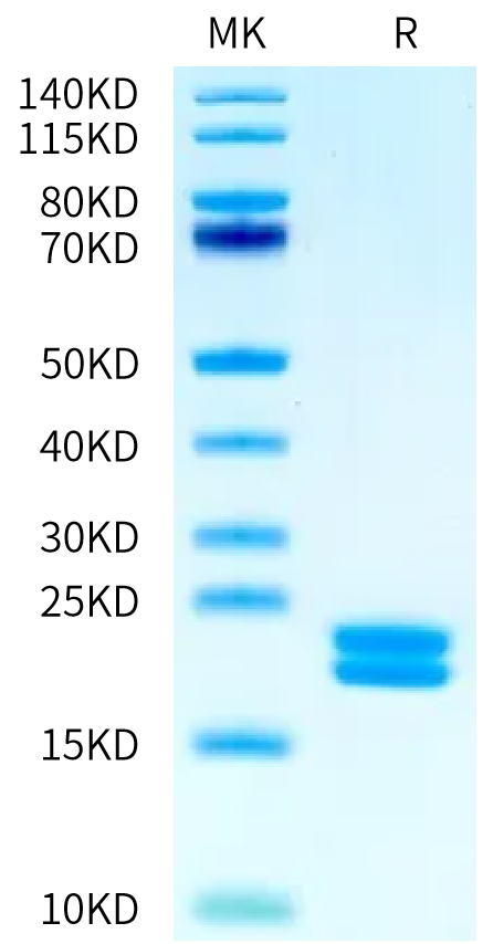 Biotinylated Human IL-2 on Bis-Tris PAGE under reduced condition. The purity is greater than 95%.Biotinylated Human IL-2 Protein, Active