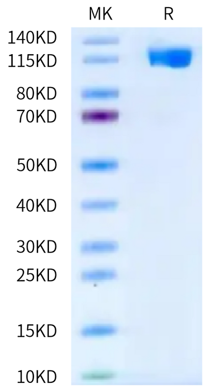 Human VCAM-1 on Bis-Tris PAGE under reduced condition. The purity is greater than 95%.Recombinant Human VCAM-1/CD106 Protein