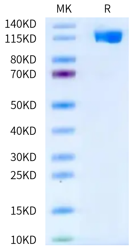 Human VCAM-1 on Bis-Tris PAGE under reduced condition. The purity is greater than 95%.Recombinant Human VCAM-1/CD106 Protein