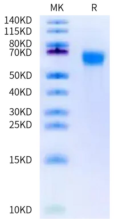 Biotinylated Mouse FGFR3 alpha (IIIb) on Bis-Tris PAGE under reduced condition. The purity is greater than 95%.Biotinylated Mouse FGFR3 alpha (IIIb) Protein