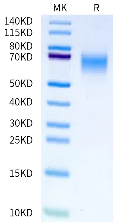 Human CDCP1 ATF (30-368) on Bis-Tris PAGE under reduced condition. The purity is greater than 95%.Recombinant Human CDCP1 ATF (30-368) Protein, Active