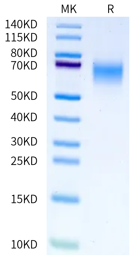 Human CDCP1 ATF (30-368) on Bis-Tris PAGE under reduced condition. The purity is greater than 95%.Recombinant Human CDCP1 ATF (30-368) Protein, Active