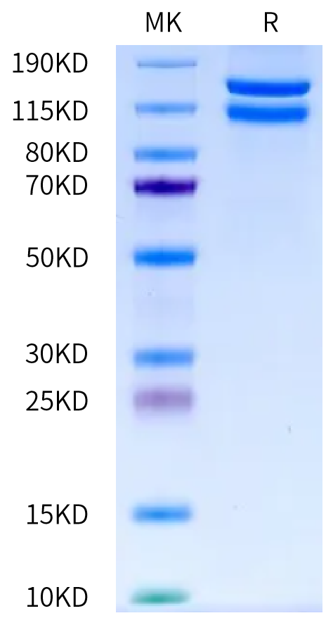 Cynomolgus ITGA2&ITGB1 on Bis-Tris PAGE under reduced condition. The purity is greater than 95%.Recombinant Cynomolgus Integrin alpha 2 beta 1 (ITGA2&ITGB1) Heterodimer Protein