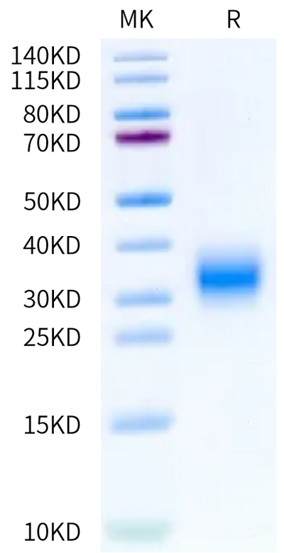 Biotinylated Human GIPR on Bis-Tris PAGE under reduced condition. The purity is greater than 95%.Biotinylated Human GIPR Protein, Active