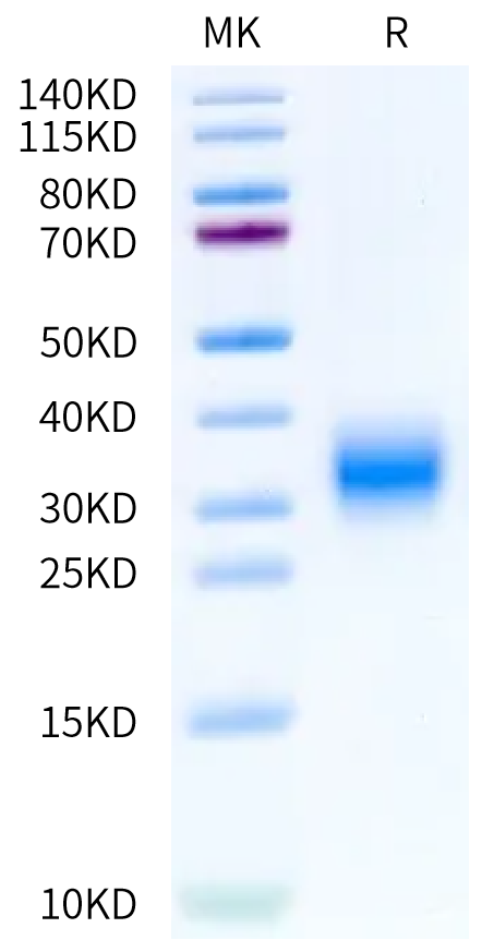 Biotinylated Human GIPR on Bis-Tris PAGE under reduced condition. The purity is greater than 95%.Biotinylated Human GIPR Protein, Active