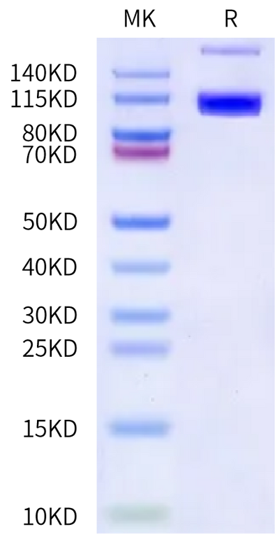 Biotinylated Human PSMA on Bis-Tris PAGE under reduced condition. The purity is greater than 90%.Biotinylated Human PSMA/FOLH1 Protein, Active