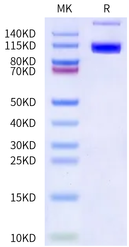 Biotinylated Human PSMA on Bis-Tris PAGE under reduced condition. The purity is greater than 90%.Biotinylated Human PSMA/FOLH1 Protein, Active