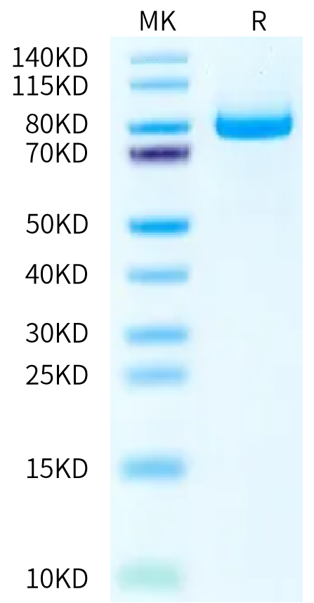 Biotinylated Human E-Cadherin on Bis-Tris PAGE under reduced condition. The purity is greater than 95%.Biotinylated Human E-Cadherin/Cadherin 1 Protein