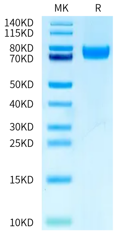 Human PLD4 (R201Q) on Bis-Tris PAGE under reduced condition. The purity is greater than 95%.Recombinant Human PLD4 (R201Q) Protein