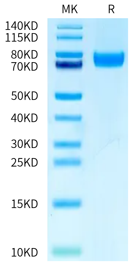 Human PLD4 (R201Q) on Bis-Tris PAGE under reduced condition. The purity is greater than 95%.Recombinant Human PLD4 (R201Q) Protein