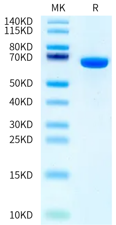 Human Serum Albumin on Bis-Tris PAGE under reduced condition. The purity is greater than 95%.Recombinant Human Serum Albumin Protein, Active