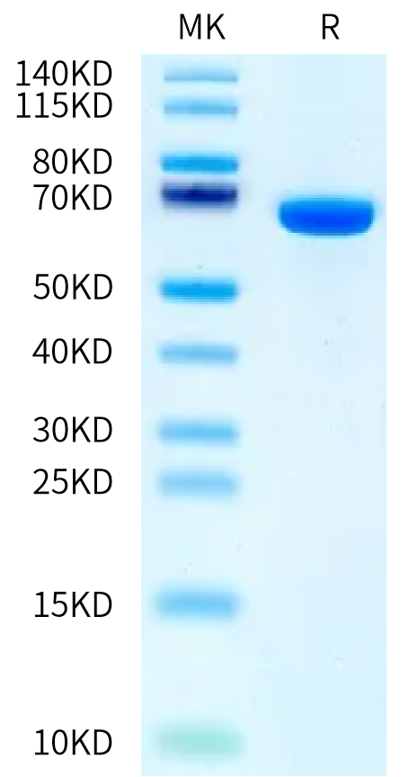 Human Serum Albumin on Bis-Tris PAGE under reduced condition. The purity is greater than 95%.Recombinant Human Serum Albumin Protein, Active