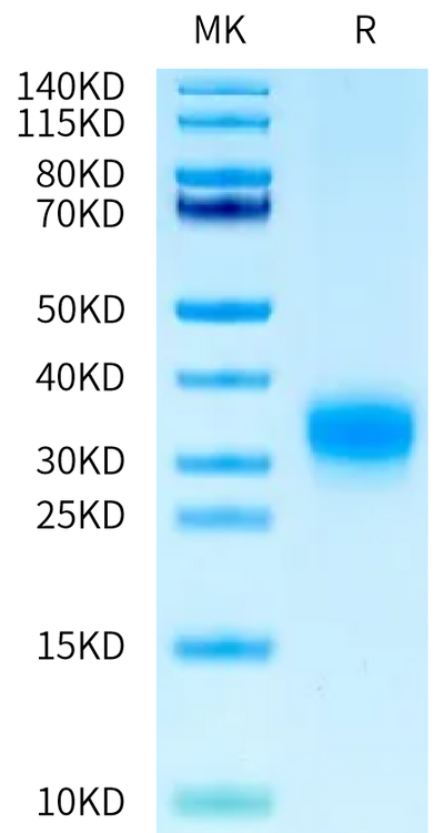 Canine RNF43 on Bis-Tris PAGE under reduced condition. The purity is greater than 95%.Recombinant Canine RNF43 Protein