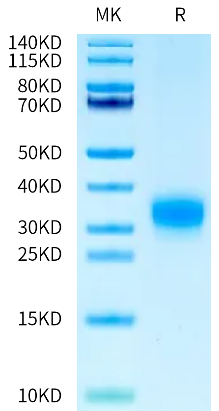 Canine RNF43 on Bis-Tris PAGE under reduced condition. The purity is greater than 95%.Recombinant Canine RNF43 Protein