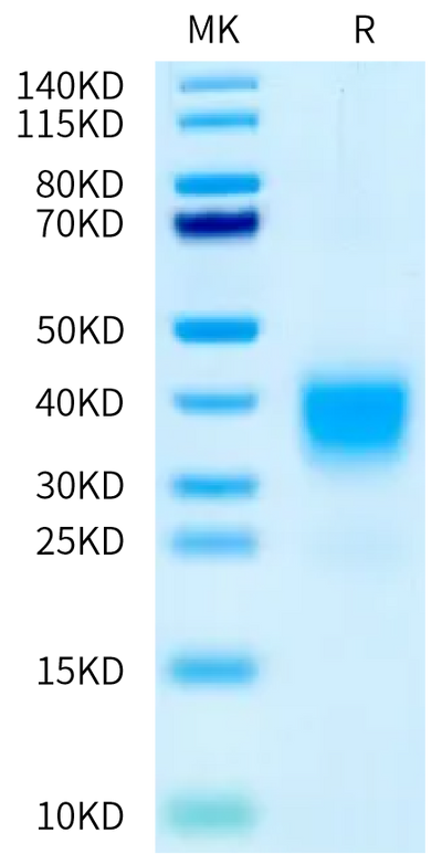 Biotinylated Human/Cynomolgus Activin RIIA on Bis-Tris PAGE under reduced condition. The purity is greater than 95%.Biotinylated Human/Cynomolgus Activin RIIA/ACVR2A Protein, Active