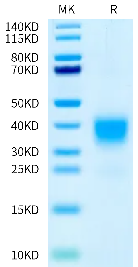 Biotinylated Human/Cynomolgus Activin RIIA on Bis-Tris PAGE under reduced condition. The purity is greater than 95%.Biotinylated Human/Cynomolgus Activin RIIA/ACVR2A Protein, Active