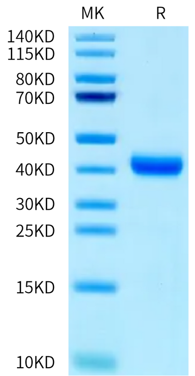 Human IL-22R alpha 1 on Bis-Tris PAGE under reduced condition. The purity is greater than 95%.Recombinant Human IL-22R alpha 1 Protein, Active