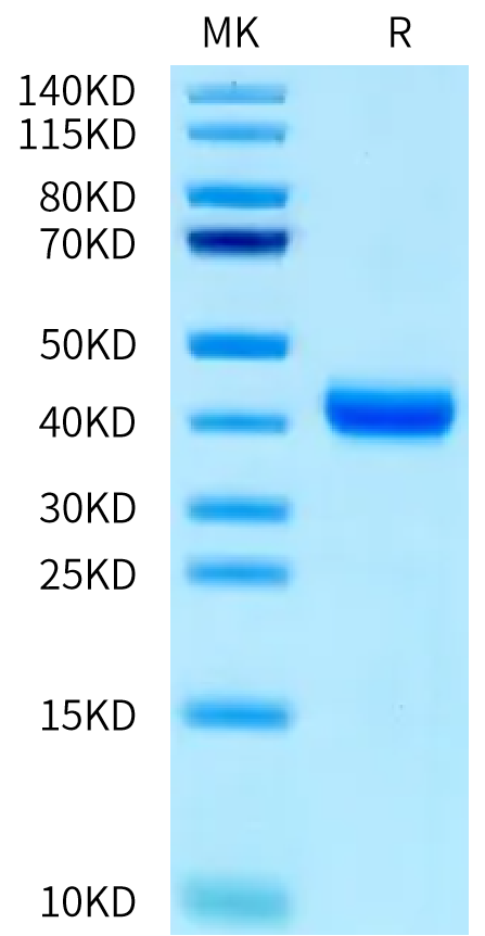 Human IL-22R alpha 1 on Bis-Tris PAGE under reduced condition. The purity is greater than 95%.Recombinant Human IL-22R alpha 1 Protein, Active