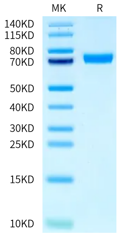 Human IL-17RE on Bis-Tris PAGE under reduced condition. The purity is greater than 95%.Recombinant Human IL-17RE Protein, Active