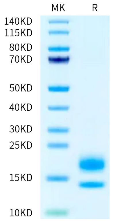 Human VEGF110 on Bis-Tris PAGE under reduced condition. The purity is greater than 95%.Recombinant Human VEGF110 Protein, Active