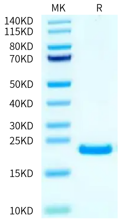 Human FGF4 on Bis-Tris PAGE under reduced condition. The purity is greater than 95%.Recombinant Human FGF4 Protein