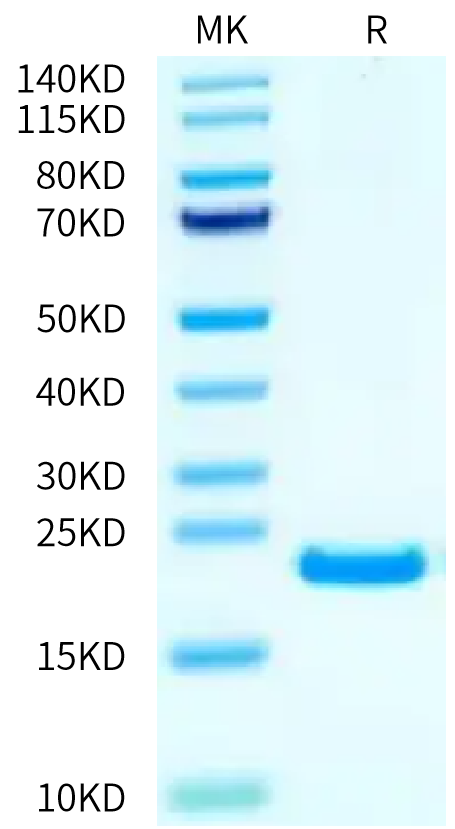 Human FGF4 on Bis-Tris PAGE under reduced condition. The purity is greater than 95%.Recombinant Human FGF4 Protein