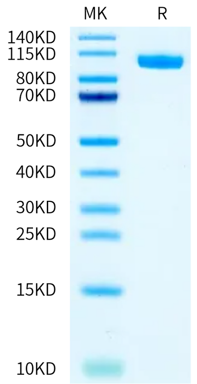 Biotinylated Human PTK7 on Bis-Tris PAGE under reduced condition. The purity is greater than 95%.Biotinylated Human PTK7/CCK4 Protein, Active