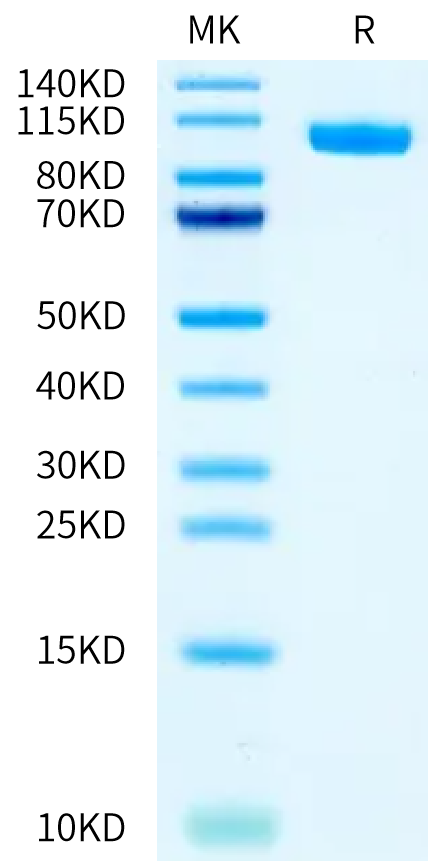 Biotinylated Human PTK7 on Bis-Tris PAGE under reduced condition. The purity is greater than 95%.Biotinylated Human PTK7/CCK4 Protein, Active