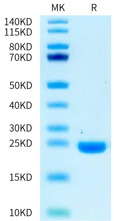 Biotinylated Mouse IL-1 Beta on Bis-Tris PAGE under reduced condition. The purity is greater than 95%.Biotinylated Mouse IL-1 Beta/IL-1F2 Protein, Active