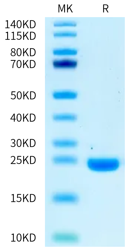 Biotinylated Mouse IL-1 Beta on Bis-Tris PAGE under reduced condition. The purity is greater than 95%.Biotinylated Mouse IL-1 Beta/IL-1F2 Protein, Active