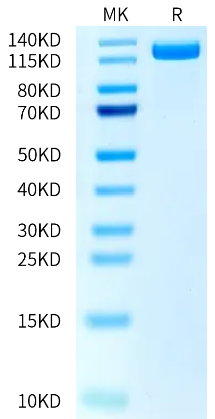 Human PTK7 on Bis-Tris PAGE under reduced condition. The purity is greater than 95%.Recombinant Human PTK7/CCK4 Protein, Active