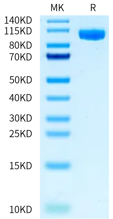 Biotinylated Mouse PTK7 on Bis-Tris PAGE under reduced condition. The purity is greater than 95%.Biotinylated Mouse PTK7/CCK4 Protein