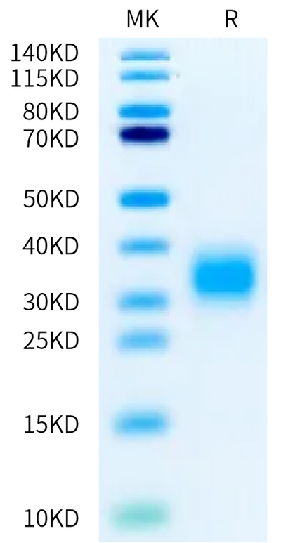 Biotinylated Cynomolgus GIPR on Bis-Tris PAGE under reduced condition. The purity is greater than 95%.Biotinylated Cynomolgus GIPR Protein, Active