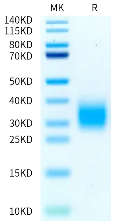 Cynomolgus GIPR on Bis-Tris PAGE under reduced condition. The purity is greater than 95%.Recombinant Cynomolgus GIPR Protein, Active