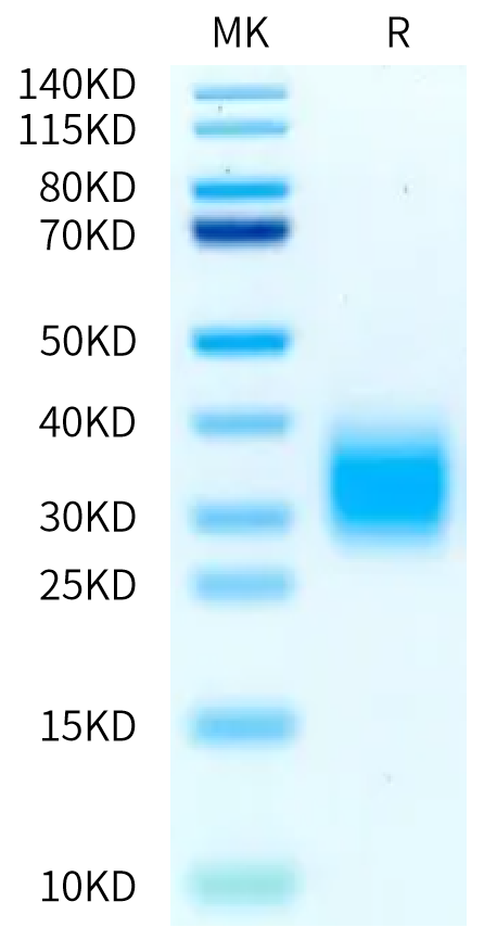 Cynomolgus GIPR on Bis-Tris PAGE under reduced condition. The purity is greater than 95%.Recombinant Cynomolgus GIPR Protein, Active