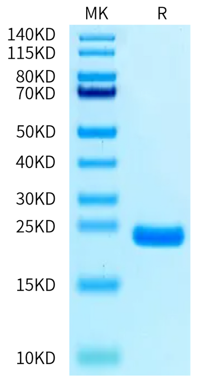 Biotinylated Cynomolgus IL-1 Beta on Bis-Tris PAGE under reduced condition. The purity is greater than 95%.Biotinylated Cynomolgus IL-1 Beta/IL-1F2 Protein, Active