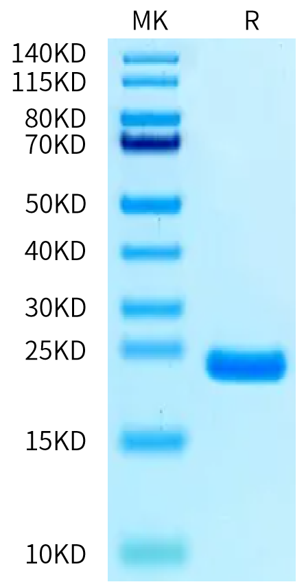 Biotinylated Cynomolgus IL-1 Beta on Bis-Tris PAGE under reduced condition. The purity is greater than 95%.Biotinylated Cynomolgus IL-1 Beta/IL-1F2 Protein, Active