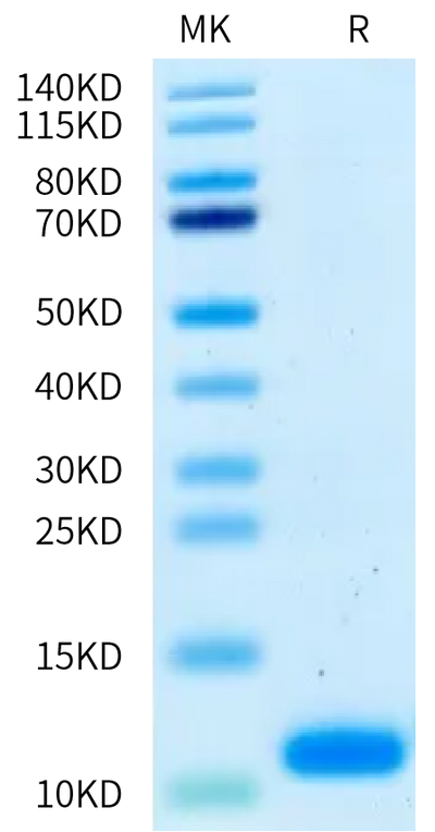 Human NRG1 Beta 1 on Bis-Tris PAGE under reduced condition. The purity is greater than 95%.Recombinant Human NRG1 Beta 1 Protein, Active